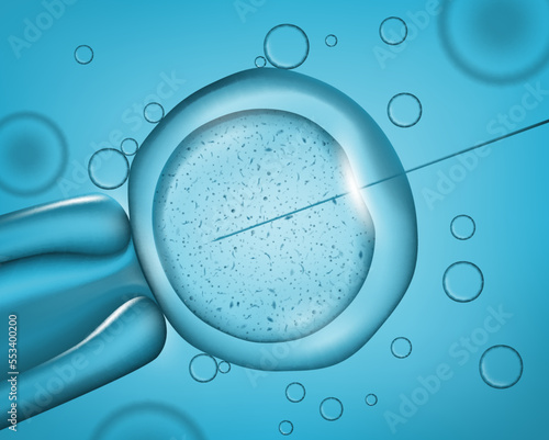Laser needle injection to cell. Medical operation. Human DNA research, biotechnology and medicine science, artificial insemination realistic vector background with needle in cell under microscope