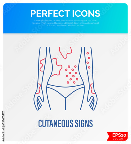 Dermatology. Dermatitis, allergy, rash, hives on body. Thin line icon. Vector illustation.