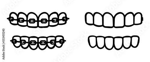 set of icons of teeth dentistry, teeth with braces and without, silhouette of teeth for dentistry eps10