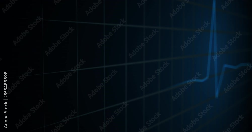 Heartbeat monitor animation. A smooth animation in high quality on a heart rate monitor in a hospital environment Heartbeat monitor animation. A smooth animation in high quality on a heart rate monitor in a hospital environment