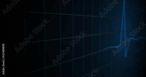 Heartbeat monitor animation. A smooth animation in high quality on a heart rate monitor in a hospital environment
