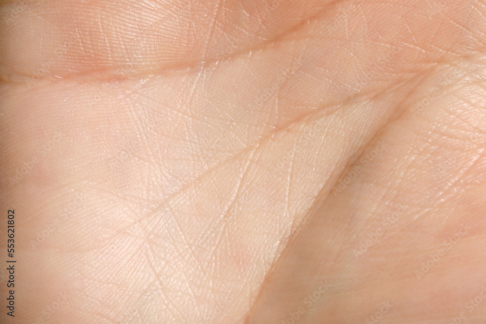 Fototapeta premium Closeup view of human hand with dry skin