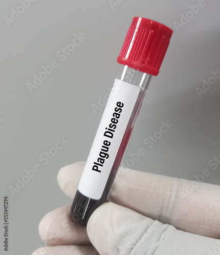 Blood sample for plague disease, an infectious disease caused by the bacteria Yersinia pestis. photo
