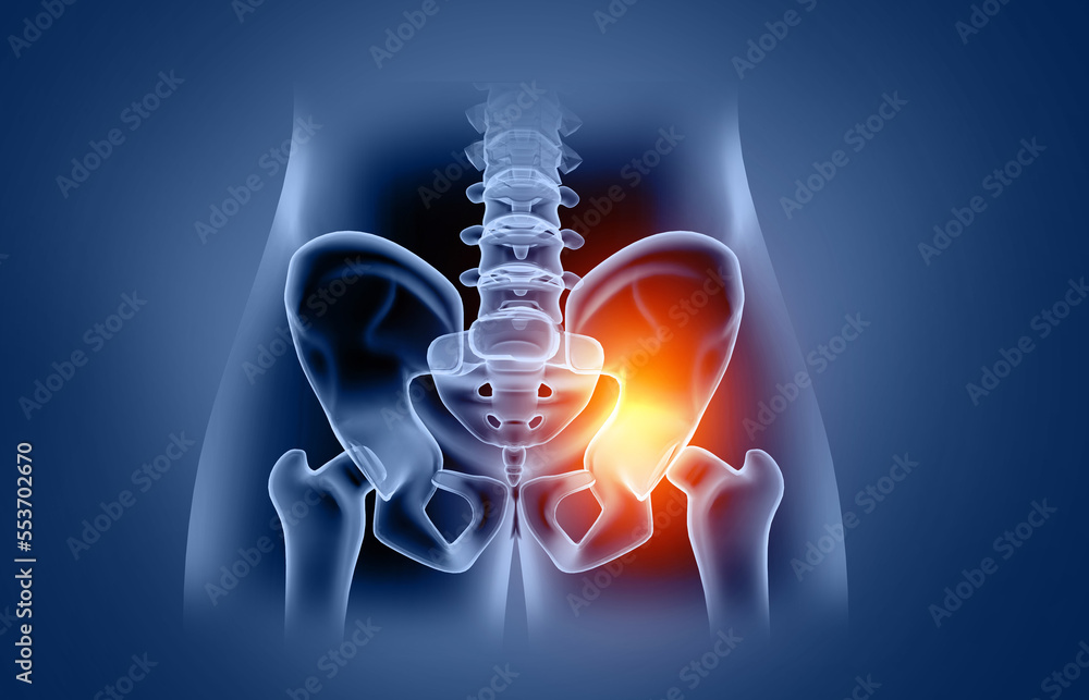 An overview of hip pain, one side pain, conditions, causes and