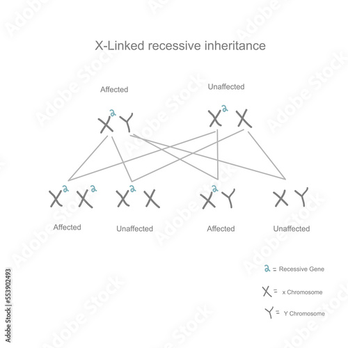 The inheritance pattern of X-Linked recessive (unaffected, affected and carried) that inherited mutation gene from parent to child