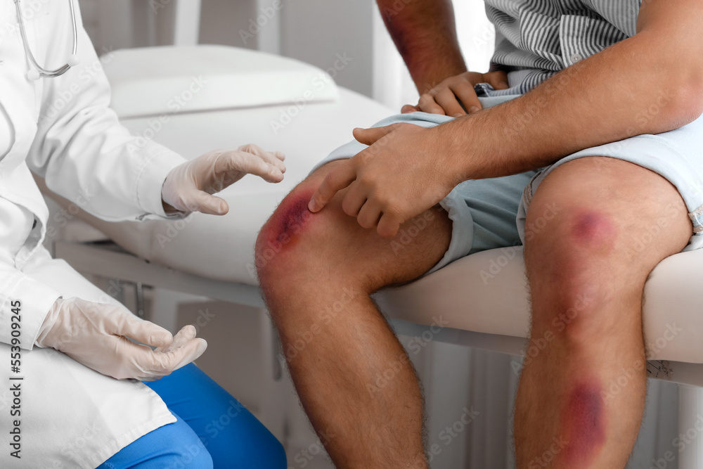 Doctor examining man with bruises in clinic Doctor examining man with bruises in clinic