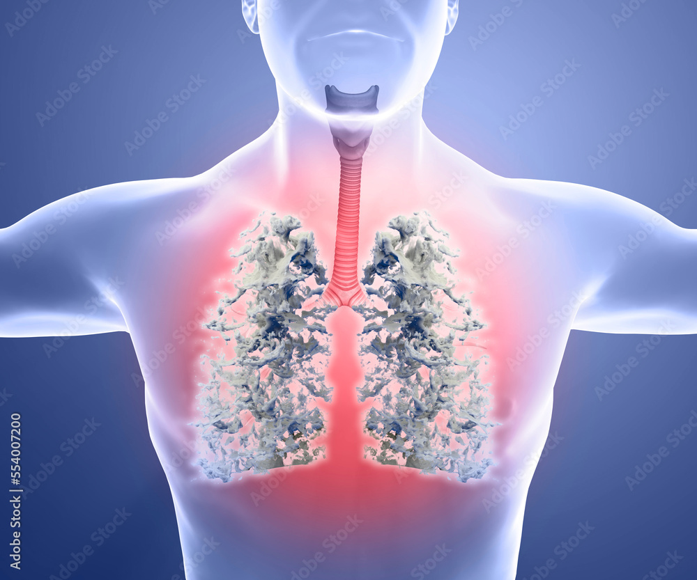 Human anatomy, problems with the respiratory system, severely damaged