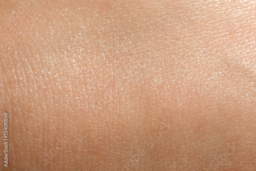 Closeup view of dry human skin as background