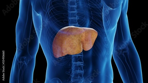 3D medical animation of a man's healthy liver turning into a fatty liver photo