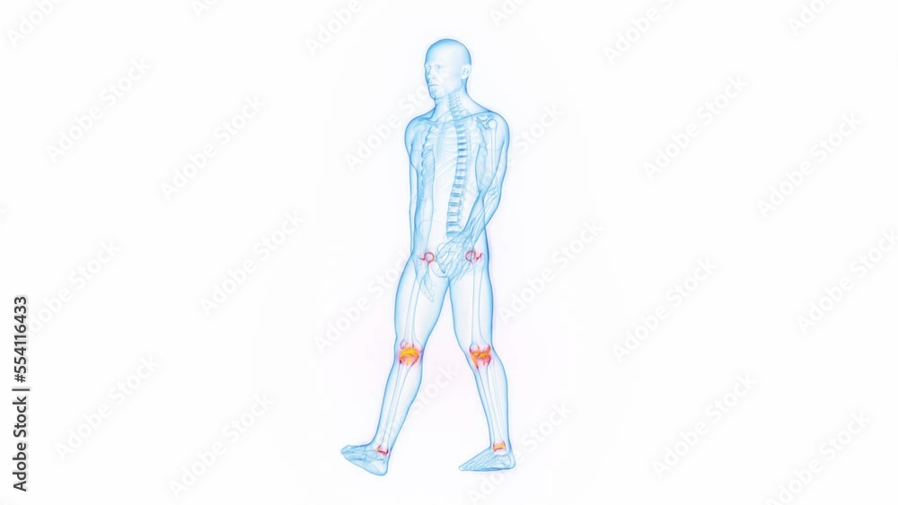 3D medical animation of a man having joint pain while walking 3D medical animation of a man having joint pain while walking