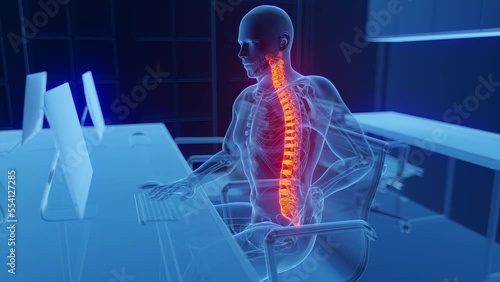 3D medical animation of a man experiencing back pain at work
