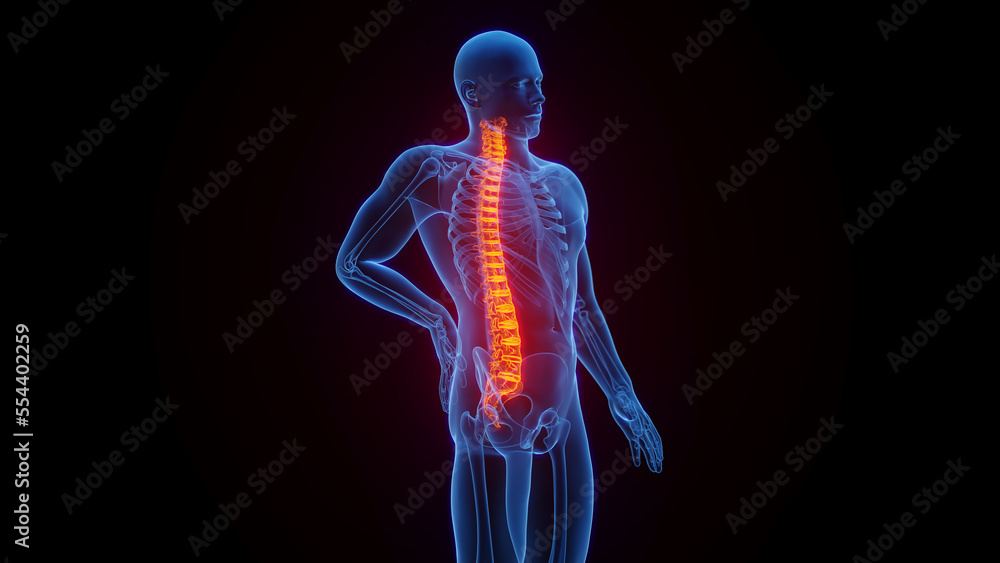 3D medical illustration of a man experiencing back pain 3D medical illustration of a man experiencing back pain