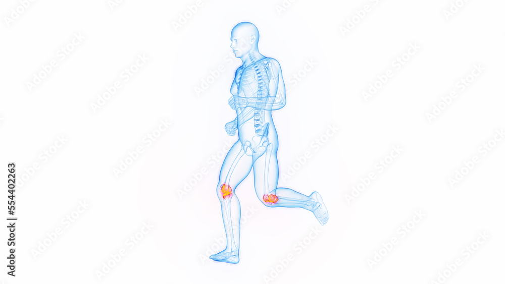 3D medical illustration of a man having knee pain while jogging 3D medical illustration of a man having knee pain while jogging