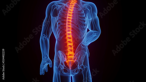 3D medical illustration of a man experiencing back pain