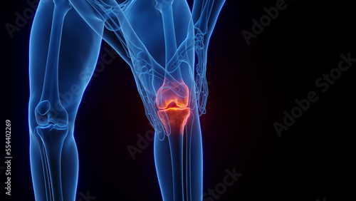 3D medical illustration of a man experiencing knee pain photo