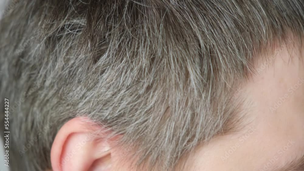 A gray-haired man shows gray hair on his temples. Hair care, the appearance of gray hair in men. A gray-haired man shows gray hair on his temples. Hair care, the appearance of gray hair in men.