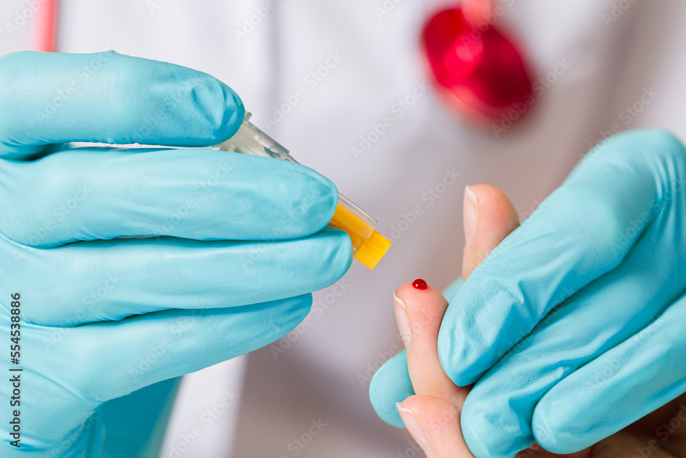 Foto de Doctor piercing patients finger with lancet in clinic closeup