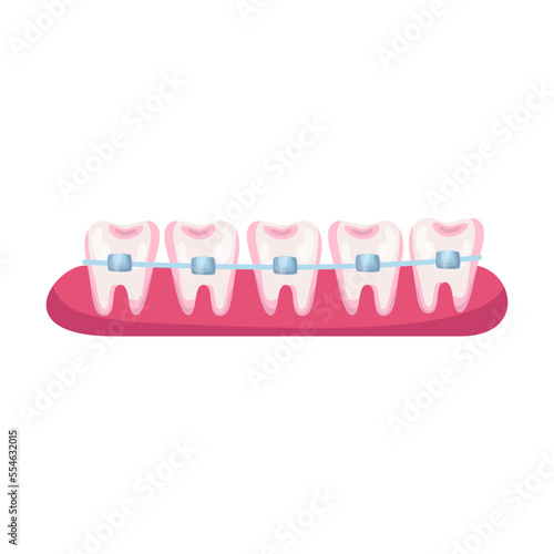 Teeth before braces cartoon illustration. Stage of dental alignment or treatment with usage of brackets for beautiful smile. Orthodontist, healthcare, medicine concept