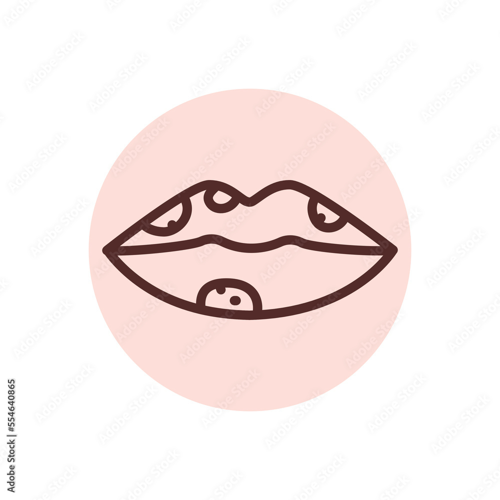 Herpes lips black line icon. Dermatology disease. Herpes lips black line icon. Dermatology disease.