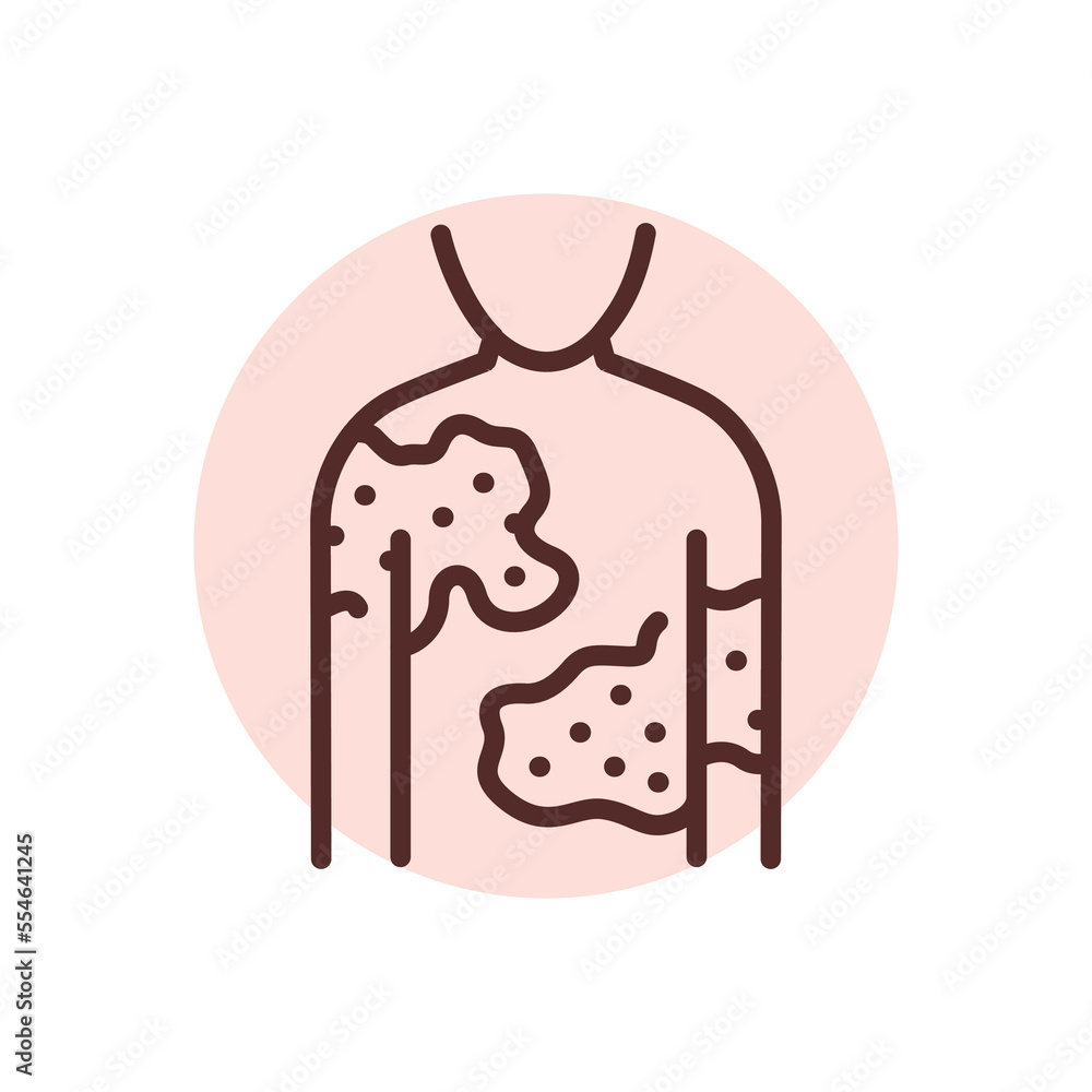 Urticaria black line icon. Dermatology disease. Urticaria black line icon. Dermatology disease.