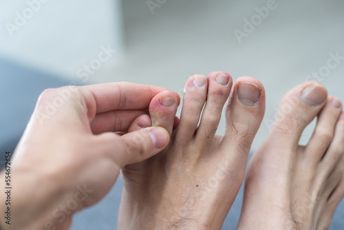 The foot and long nail toes on white concrete background. Long nails and dirty may cause fungal.