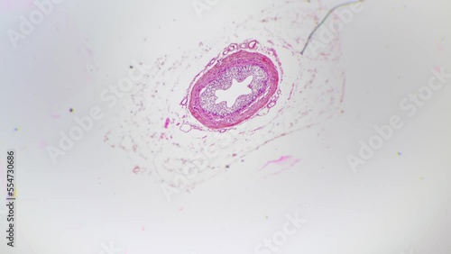 Human ureter in cross section filmed under light micrograph 40x on white background. Macro footage of organ which propel urine from the kidneys to the urinary bladder. Investigating anatomy in the lab photo