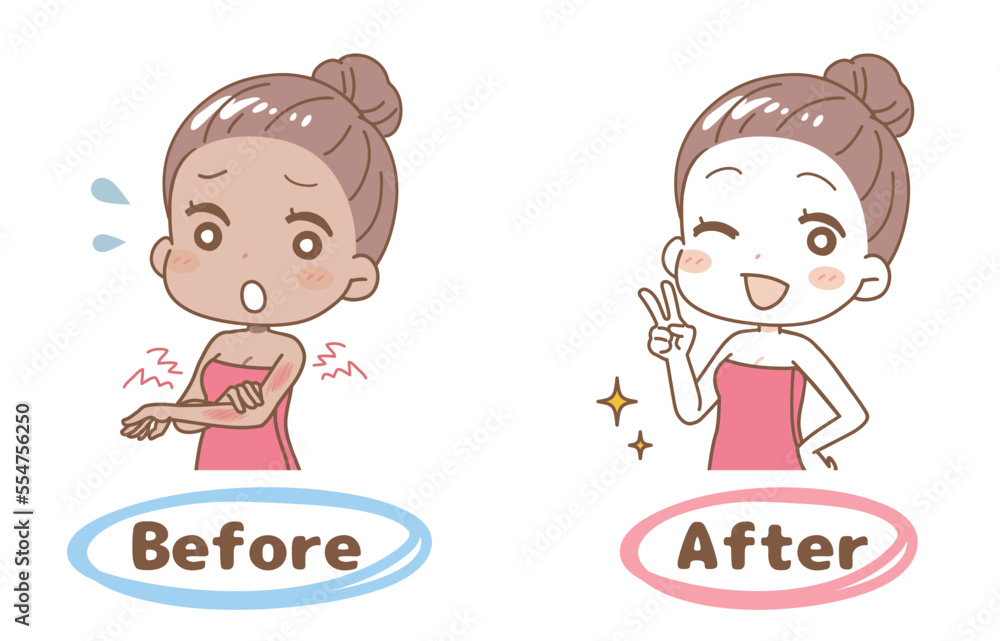 Set illustration of before and after sunburn, upper body. Set illustration of before and after sunburn, upper body.