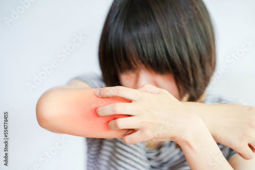 Itching (Pruritus) is a common skin condition that often leads to scratching.