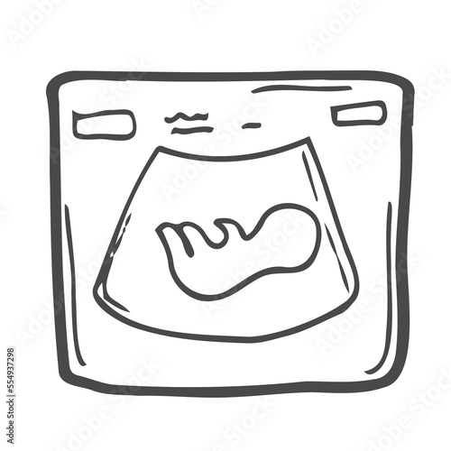 Fetal ultrasound hand drawn outline doodle icon. Pregnancy sonogram of a fetus in womb vector sketch illustration for print, web, mobile and infographics isolated on white background.
