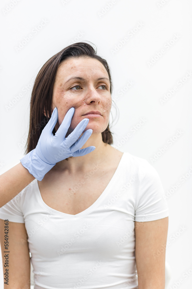 Photo of female face and hand in medical glove.