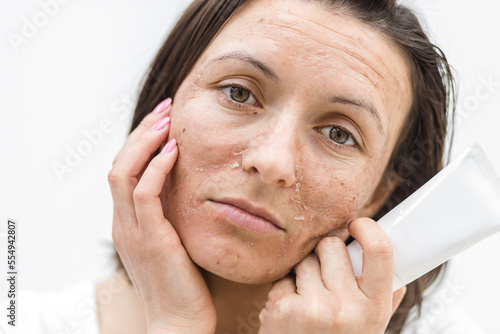 Cropped photo of woman with dry skin and cream on white background.