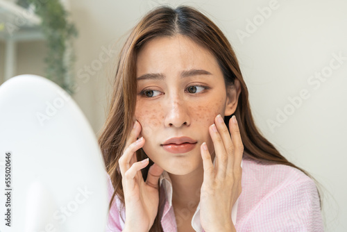 Dermatology, expression face worry asian young woman looking mirror hand touch facial at dark spot of melasma, freckles from pigment melanin, allergy sun. Beauty care, skin problem treatment, skincare photo