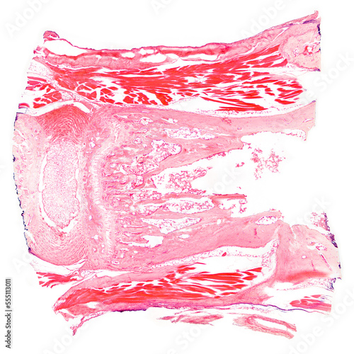 Tendon, section, 20X light micrograph. Piece of sinew, stained with hematoxylin and eosin, under the microscope. High-tensile-strength band of dense fibrous connective tissue, connects muscle to bone. photo