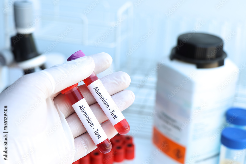 aluminium test to look for abnormalities from blood aluminium test to look for abnormalities from blood