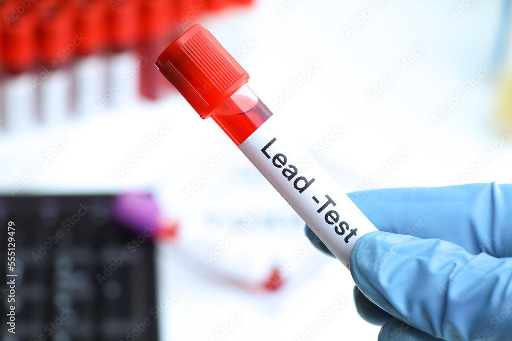 Lead test to look for abnormalities from blood