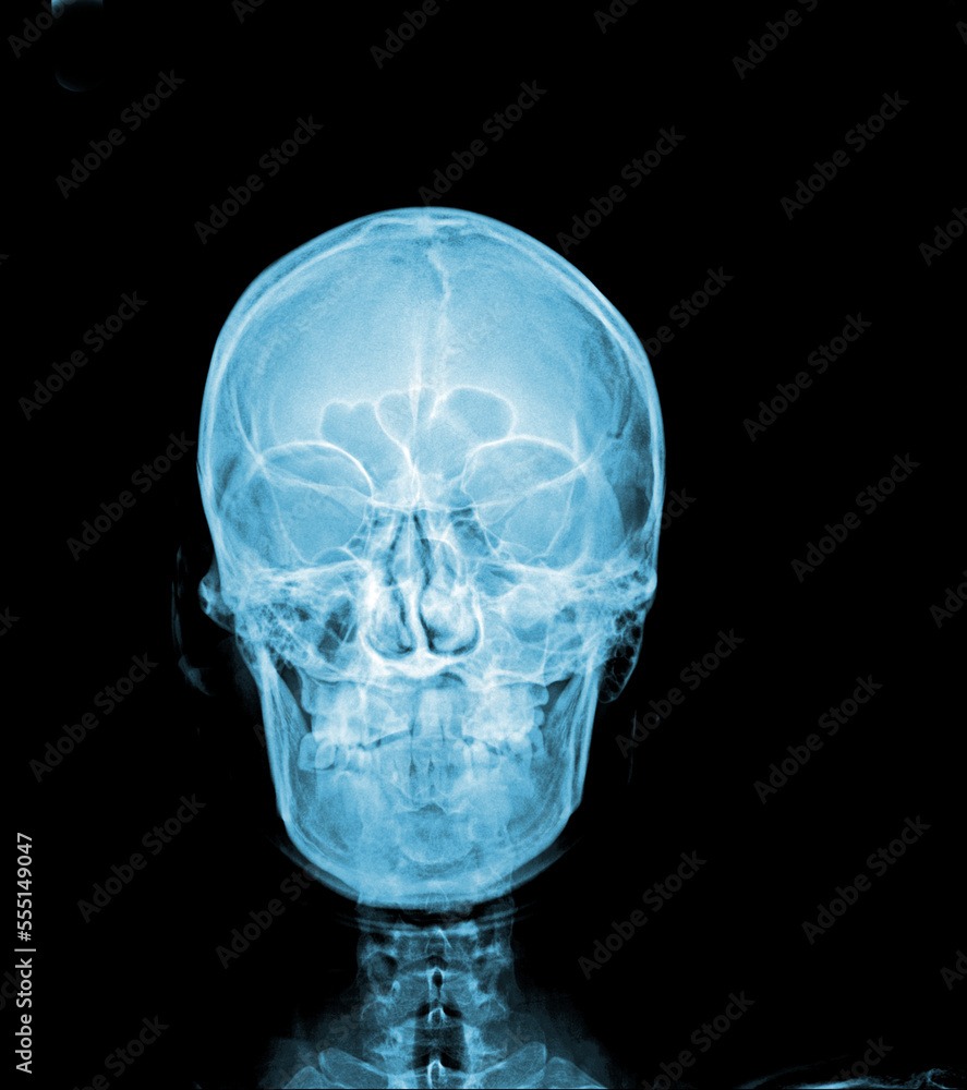 human skull ray human skull ray