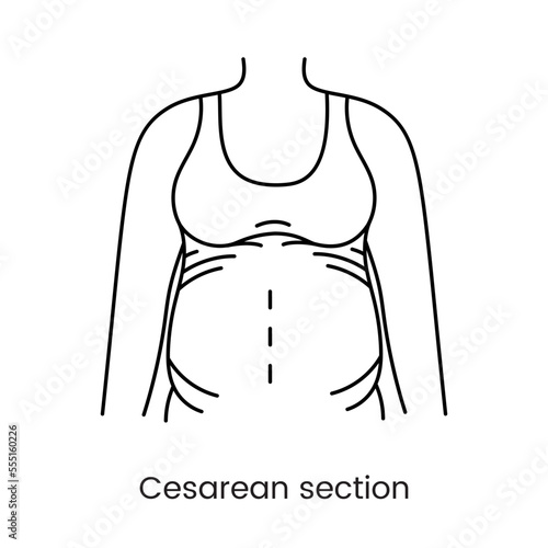 Caesarean section views icon line in vector, illustration of a pregnant woman.