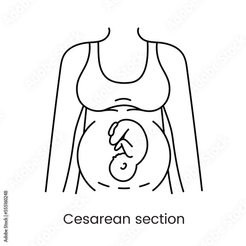 Caesarean section views icon line in vector, illustration of a pregnant woman.