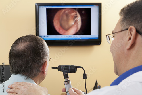 Audiologist doing live video inspection of ear canal while a patient watches on a computer screen photo