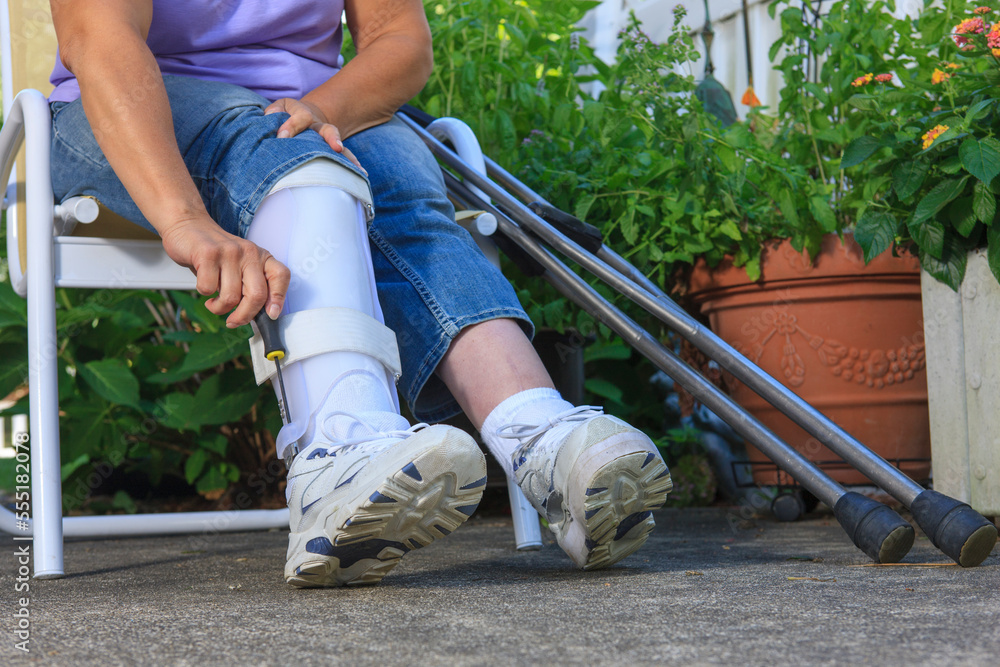 Woman with Spina Bifida adjusting leg brace so she can walk Stock Photo