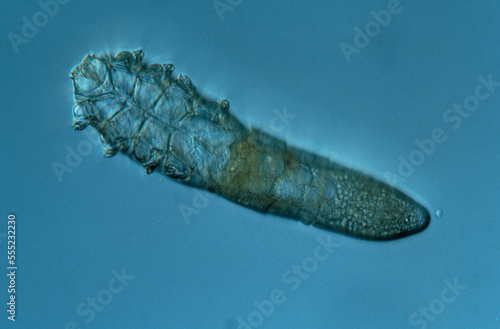 A follicle mite taken from a hear follicle on a person's forehead.; SOMERVILLE, MASSACHUSETTS. photo
