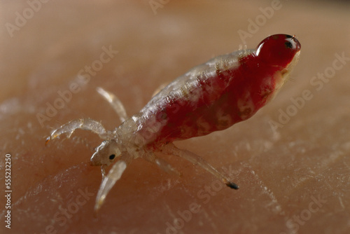 Body louse (Pediculus humanus) taking a blood meal from a person.; United States. photo