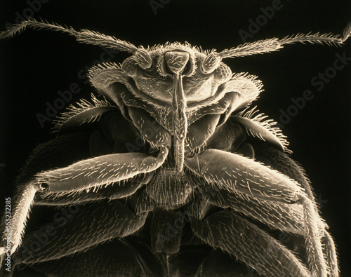 View of a common bedbug (Cimex lectularius) magnified 90 times normal size.; MASSACHUSETTS.