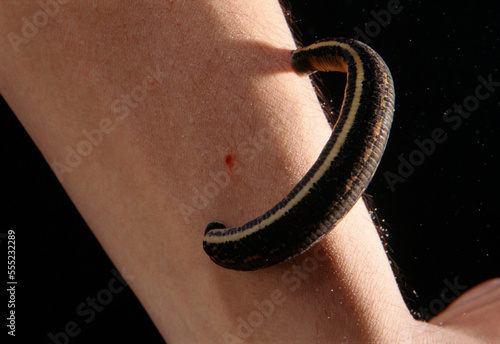A medical leech (Hirudo medicinalis) feeding on an arm.  They are currently use d by doctors to help estalish circulation after limb reattachments.; U.S.A. photo