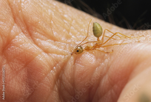 A green tree ant squirts acid into a bite on a human skin.; North Queensland, Australia. photo