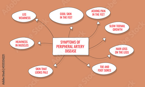 symptoms of Peripheral artery disease. Vector illustration for medical journal or brochure.

