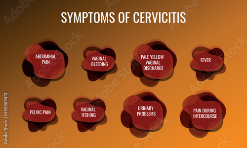 symptoms of Cervicitis. Vector illustration for medical journal or brochure. photo