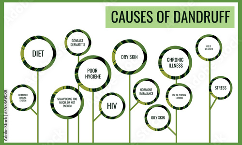 Causes of Dandruff. Vector illustration for medical journal or brochure.
