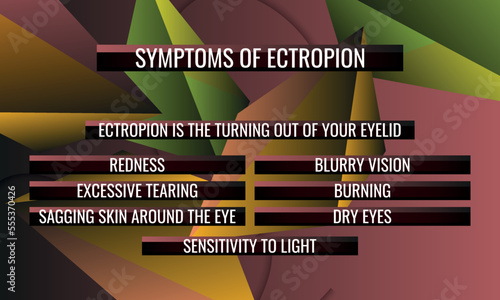Symptoms of Ectropion. Vector illustration for medical journal or brochure.
 photo