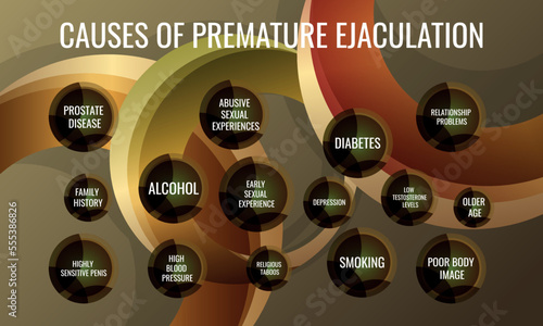 Causes of Premature Ejaculation. Vector illustration for medical journal or brochure.
